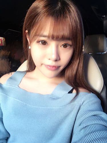 北京禾美嘉注射玻尿酸豐唇+豐臥蠶 讓我更美啦~