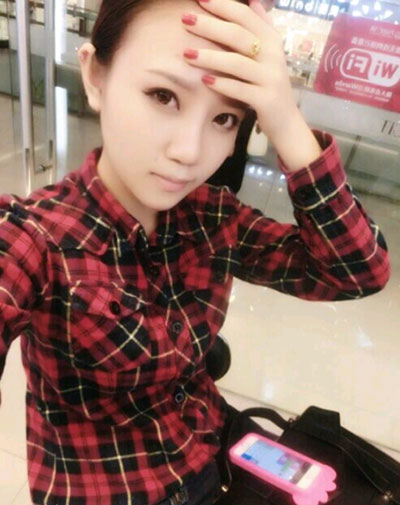 假體隆鼻15天后恢復(fù)果 杭州時(shí)光做的~