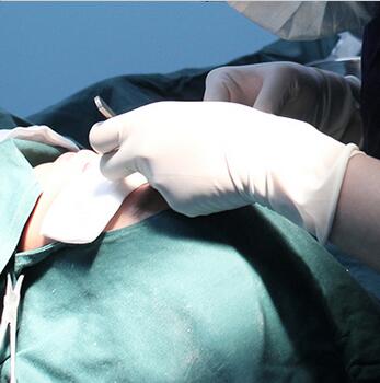 雙眼皮手術讓我單眼皮變雙眼皮就是這么簡單