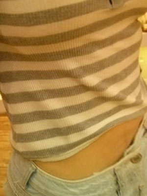 北京常好麗格腰腹吸脂后20天的感受 恢復(fù)日記來(lái)咯~