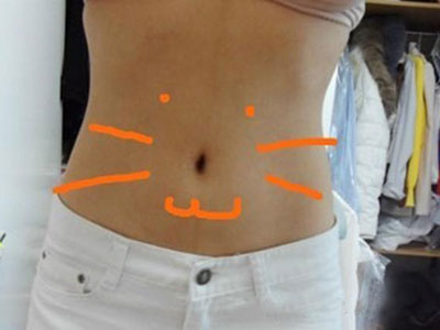 北京常好麗格腰腹吸脂后20天的感受 恢復(fù)日記來(lái)咯~