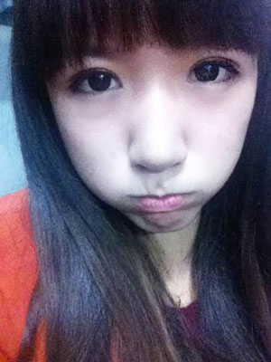 北北京常好麗格三點定位雙眼皮恢復一個月經(jīng)歷