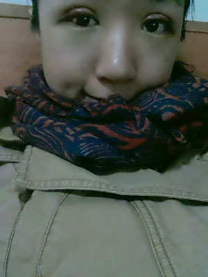 北北京常好麗格三點定位雙眼皮恢復一個月經(jīng)歷