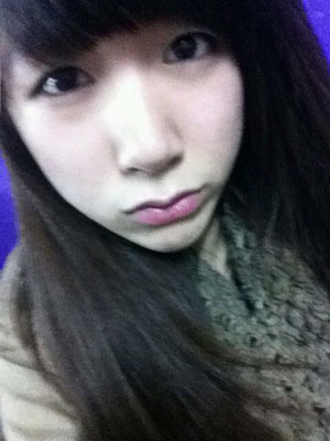 北北京常好麗格三點定位雙眼皮恢復一個月經(jīng)歷