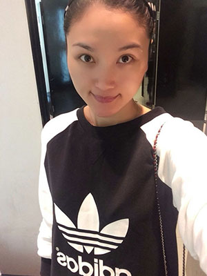 北京常好麗格做假體隆鼻3個月