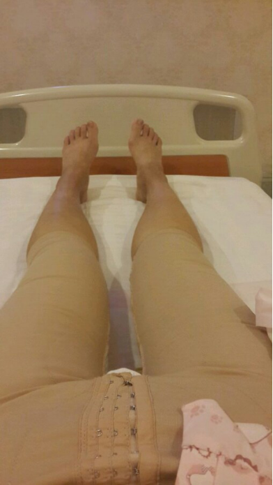 水動力吸脂瘦大腿讓我夏天放肆嗨