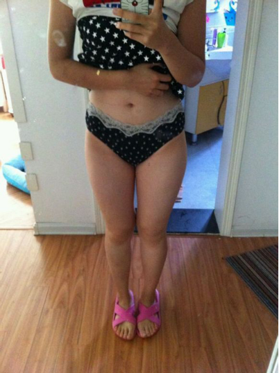 水動力吸脂瘦大腿讓我夏天放肆嗨