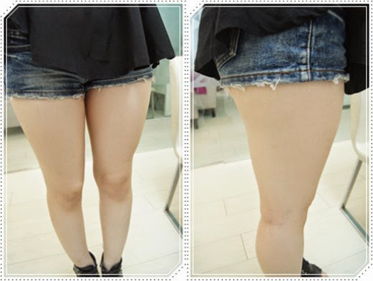 自體脂肪豐胸讓我的小平胸變成大豪乳