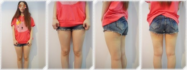 自體脂肪豐胸讓我的小平胸變成大豪乳