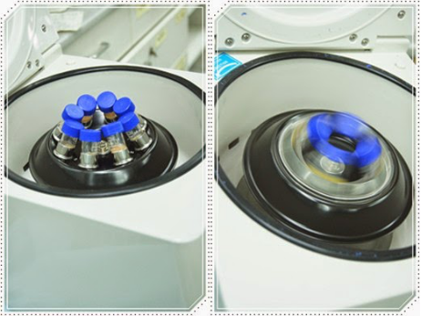 自體脂肪豐胸讓我的小平胸變成大豪乳