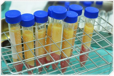 自體脂肪豐胸讓我的小平胸變成大豪乳