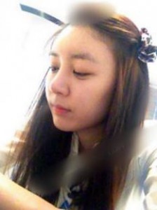 北京清木隆鼻整形后 **變身