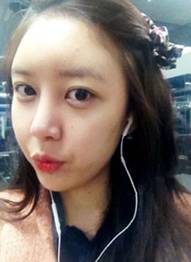 北京清木隆鼻整形后 **變身