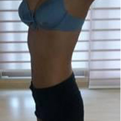 北京清木腰腹吸脂3個月感受