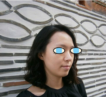 做了膨體隆鼻我也有了高鼻梁 **