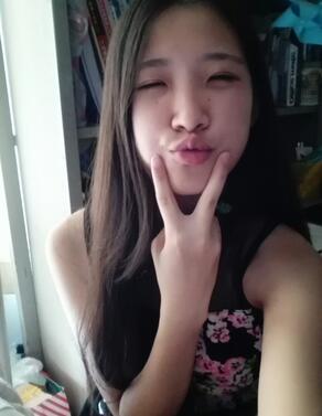 雙眼皮15天恢復記錄