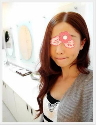 埋埋蛋白線(xiàn).提升拯救了我的大小臉和皮膚下垂