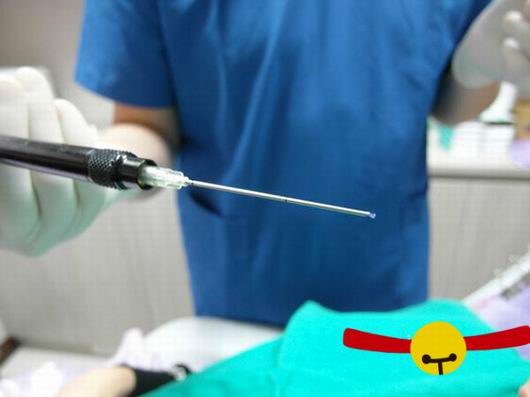 Misko隆鼻讓我鼻子變得挺拔嬌俏無壓力