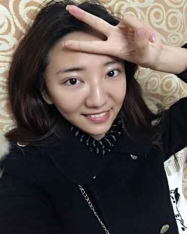 北京歐華去痘坑痘印兩個月