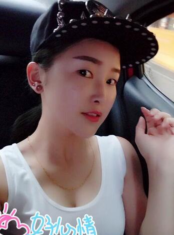 愛(ài)悅麗格玻尿酸豐蘋(píng)果肌、豐下巴、隆鼻