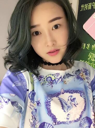 愛(ài)悅麗格玻尿酸豐蘋(píng)果肌、豐下巴、隆鼻