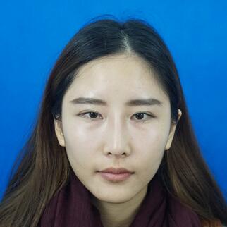 愛(ài)悅麗格膠原蛋白豐蘋(píng)果肌分享