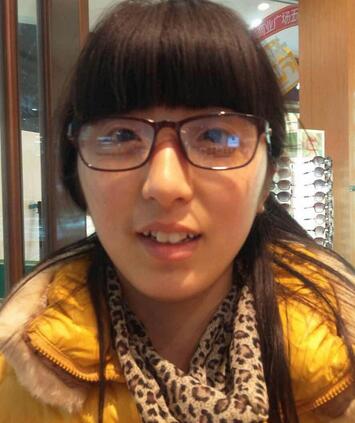 愛(ài)悅麗格玻尿酸豐臉頰日記分享