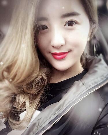 愛(ài)悅麗格玻尿酸豐臉頰日記分享