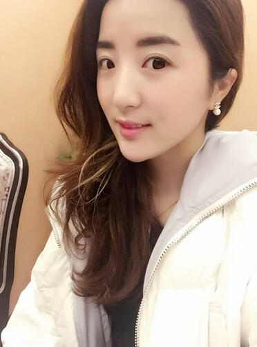 愛(ài)悅麗格玻尿酸豐臉頰日記分享