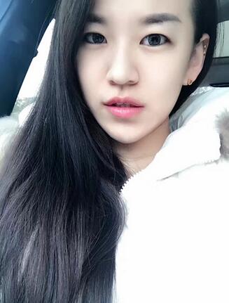 梨花雨注射注射瘦臉去眉間紋日記