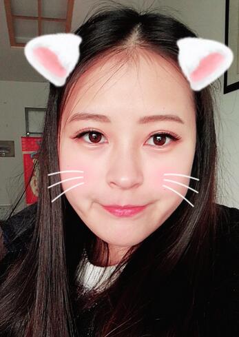 梨花雨割雙眼皮恢復(fù)半年了