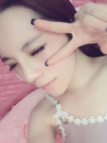 梨花雨隆鼻整形的恢復(fù)經(jīng)歷