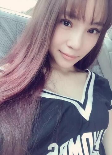 梨花雨隆鼻整形的恢復(fù)經(jīng)歷