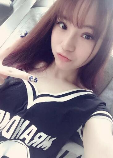 梨花雨隆鼻整形的恢復(fù)經(jīng)歷