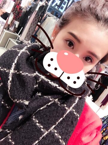 上海韓鏡割雙眼皮一個(gè)月