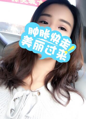 上海韓鏡割雙眼皮一個(gè)月