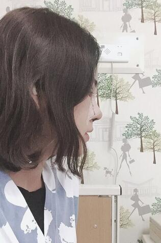 上海韓鏡網(wǎng)紅套餐半個月經(jīng)歷 雙眼皮多項整形+隆鼻整形+脂肪填充