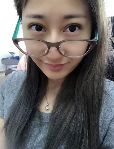 埋線雙眼皮七天恢復(fù)圖