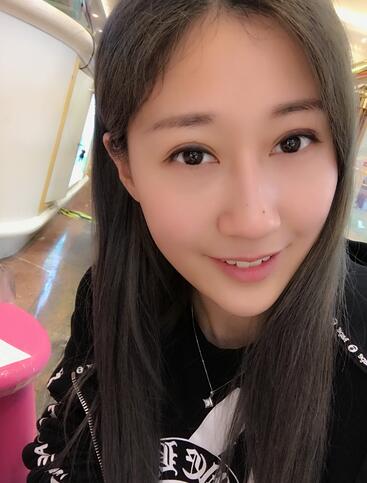 埋線雙眼皮七天恢復(fù)圖