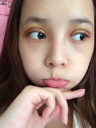 深圳晨曦微創(chuàng)定點(diǎn)每天恢復(fù)圖 美爆了~