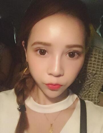 深圳晨曦微創(chuàng)定點(diǎn)每天恢復(fù)圖 美爆了~