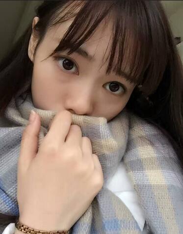 深圳晨曦三點定位雙眼皮日記