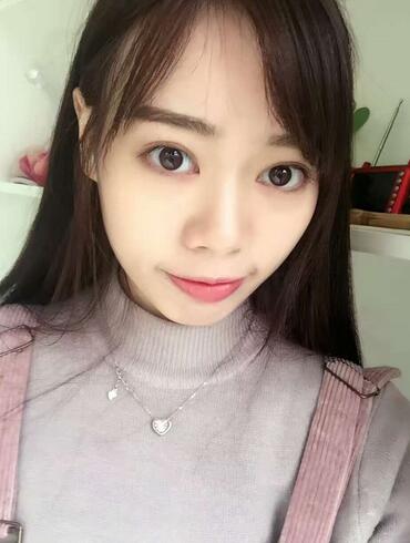 深圳晨曦三點定位雙眼皮日記