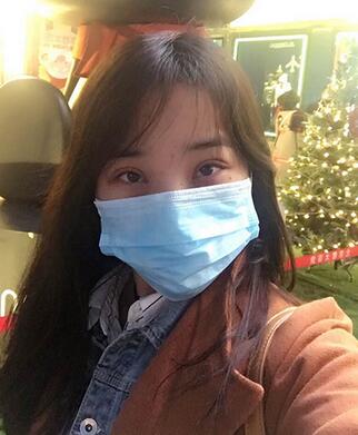 開眼角加雙眼皮15天恢復(fù)圖