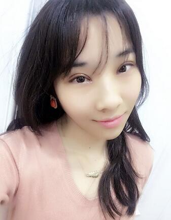 開眼角加雙眼皮15天恢復(fù)圖