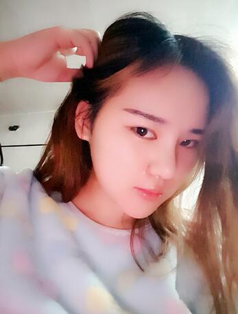 假體墊下巴一個(gè)月 前后對(duì)比