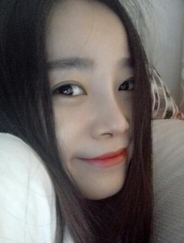 隆鼻整形日記 重慶鉑生硅膠隆鼻＋耳軟骨鼻尖