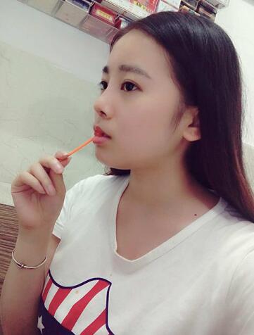 隆鼻整形日記 重慶鉑生硅膠隆鼻＋耳軟骨鼻尖