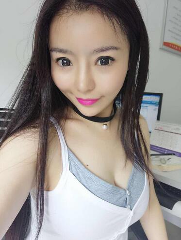 發(fā)際線調(diào)整案例分享 北京熙朵發(fā)際線+眉毛種植