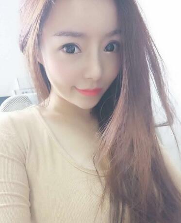 發(fā)際線調(diào)整案例分享 北京熙朵發(fā)際線+眉毛種植